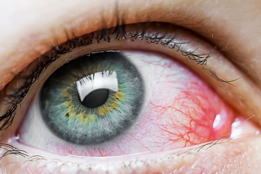 Encuentran la causa por la que el coronavirus podría ingresar al organismo a través de los ojos